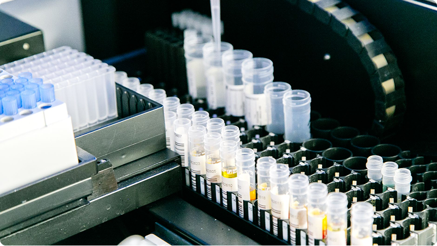 AI-powered healthcare diagnostics and urinalysis platform